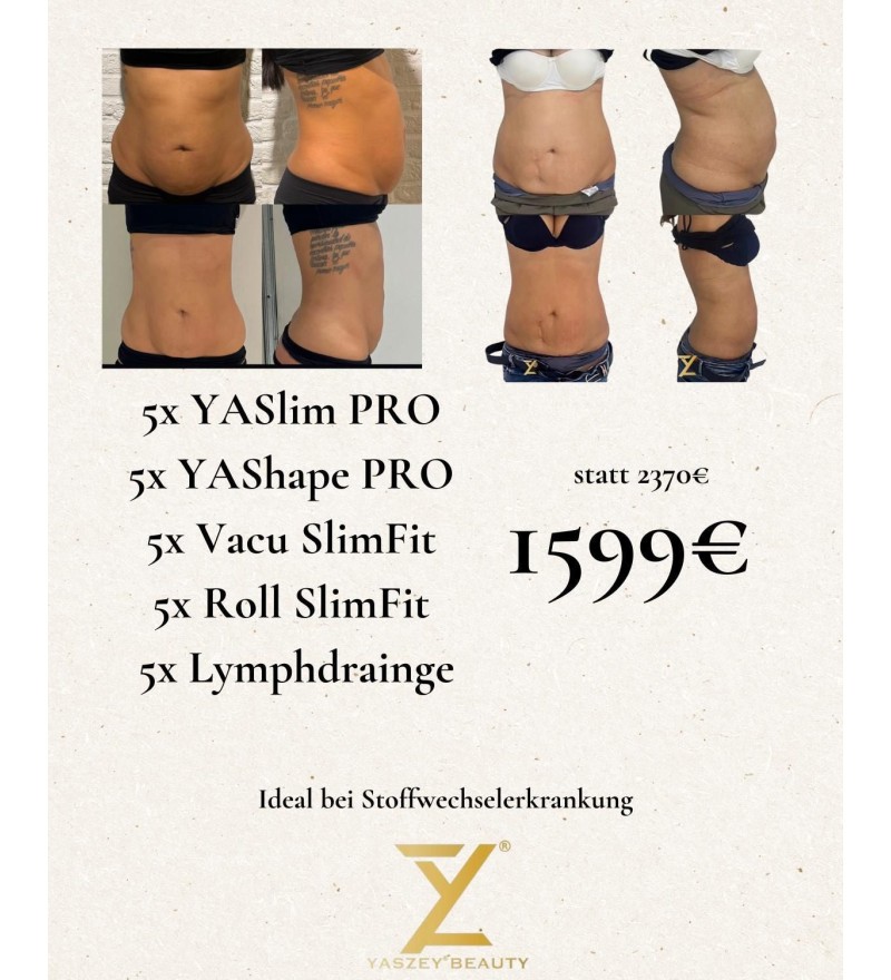 Bodyforming-pakket 4 – Stofwisselingscombi (5x YASlim Pro, YAShape Pro, Vacu SlimFit, Roll SlimFit, lymfedrainage)