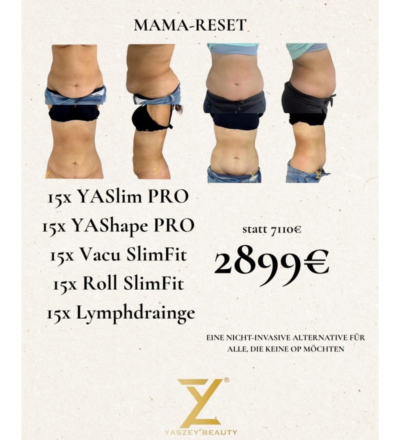 Bodyforming-pakket 8 – Mama Reset (15x YASlim Pro, YAShape Pro, Vacu SlimFit, Roll SlimFit, lymfedrainage)